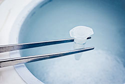 Egg Freezing for Cancer Patients