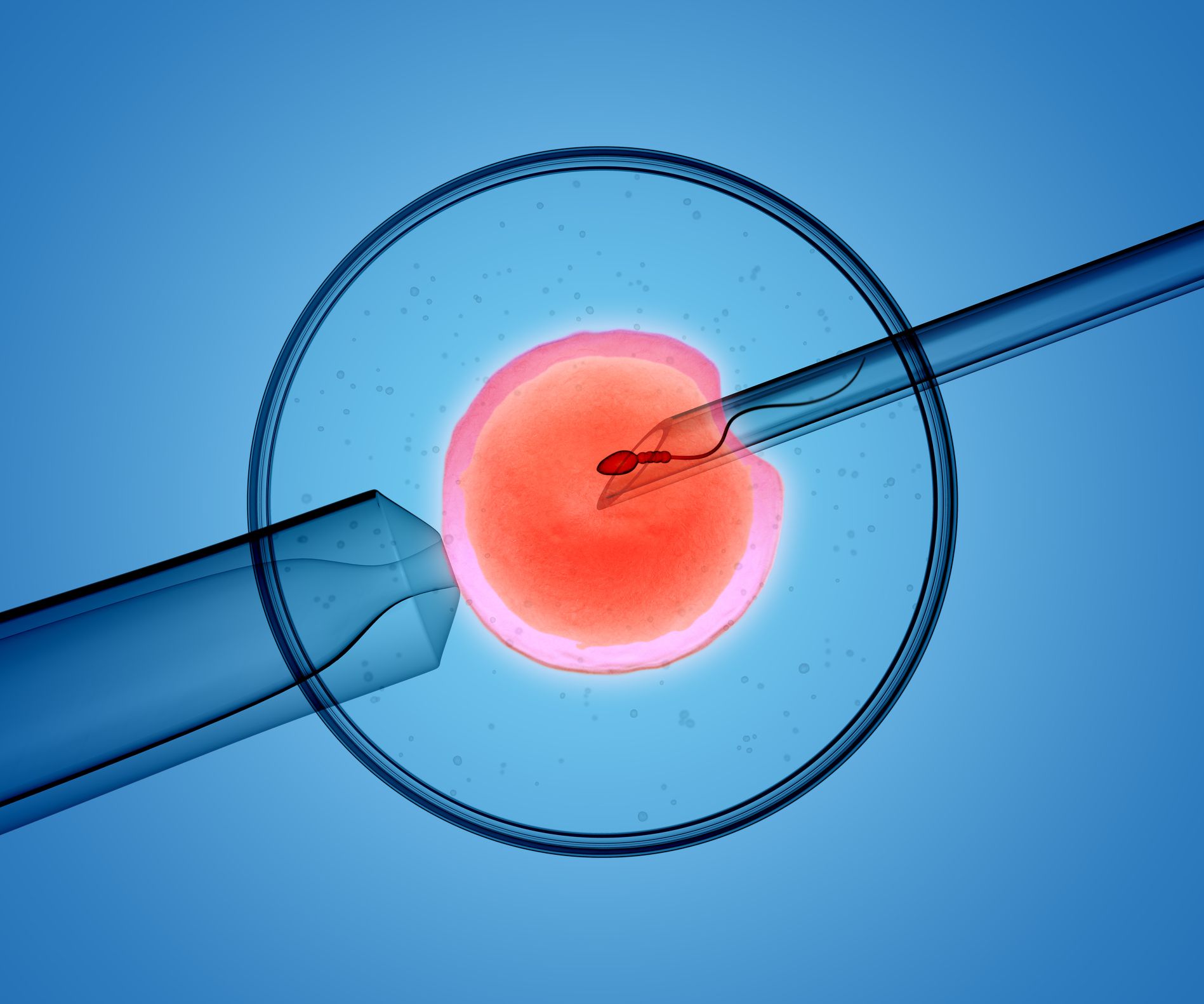 In Vitro Fertilization (IVF) Scottsdale AZ